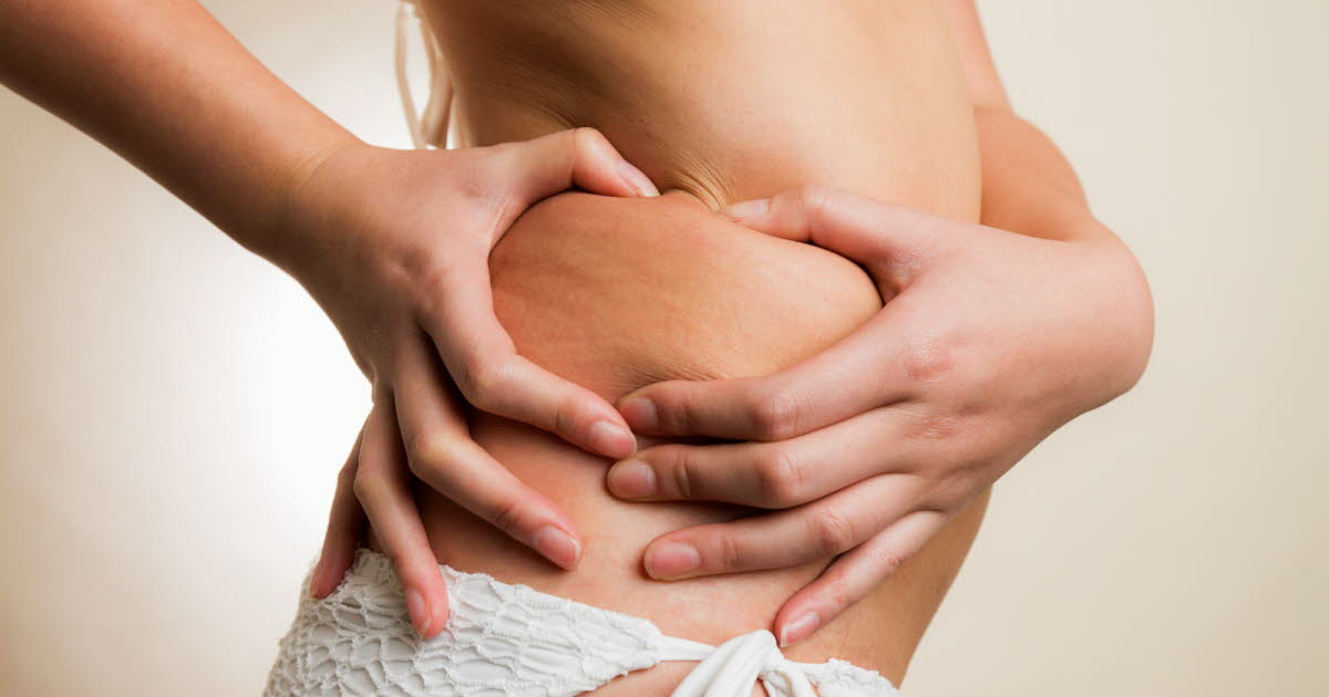Accepter son corps en maillot de bain : conseils pour se libérer des complexes