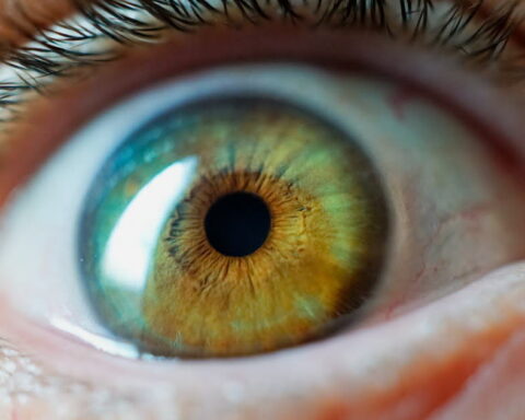 La kérato-pigmentation : une chirurgie esthétique des yeux aux risques non négligeables