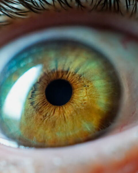La kérato-pigmentation : une chirurgie esthétique des yeux aux risques non négligeables