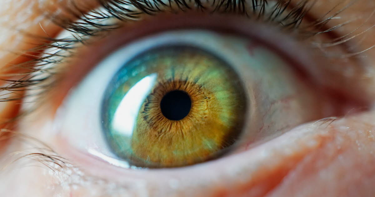 La kérato-pigmentation : une chirurgie esthétique des yeux aux risques non négligeables