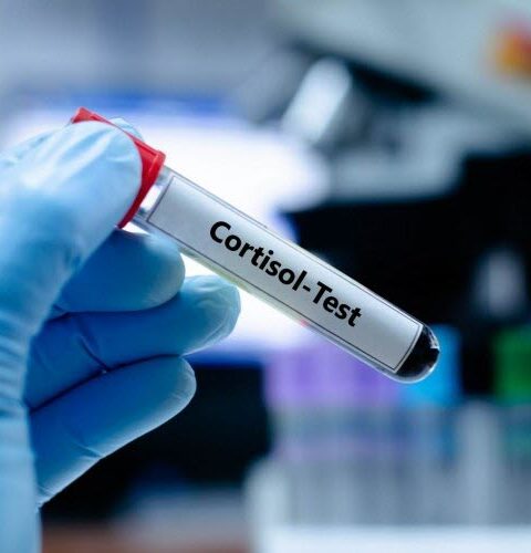 Le cortisol : une hormone essentielle mal comprise et victime de désinformation