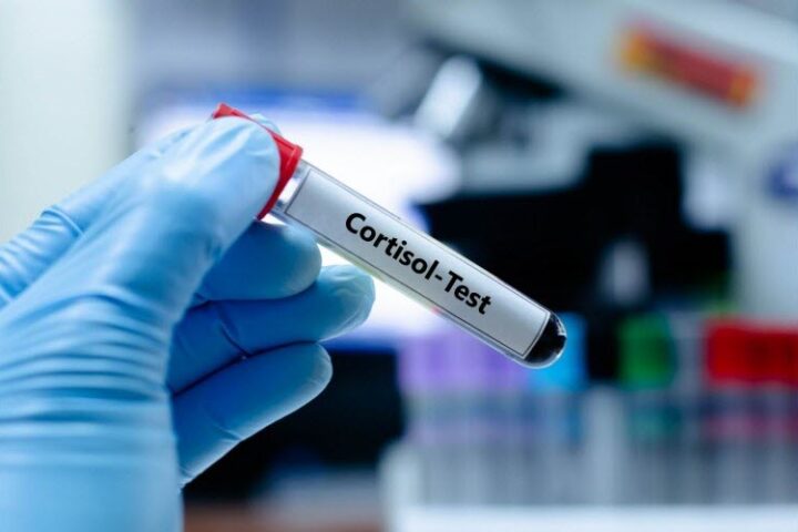Le cortisol : une hormone essentielle mal comprise et victime de désinformation