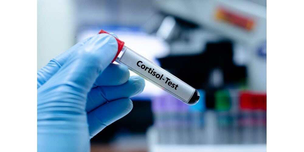 Le cortisol : une hormone essentielle mal comprise et victime de désinformation