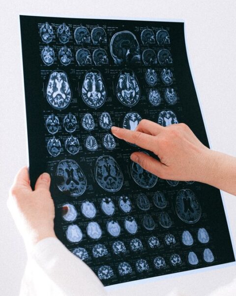 Un Gallois découvre un glioblastome après avoir consulté sur l'insistance de sa femme