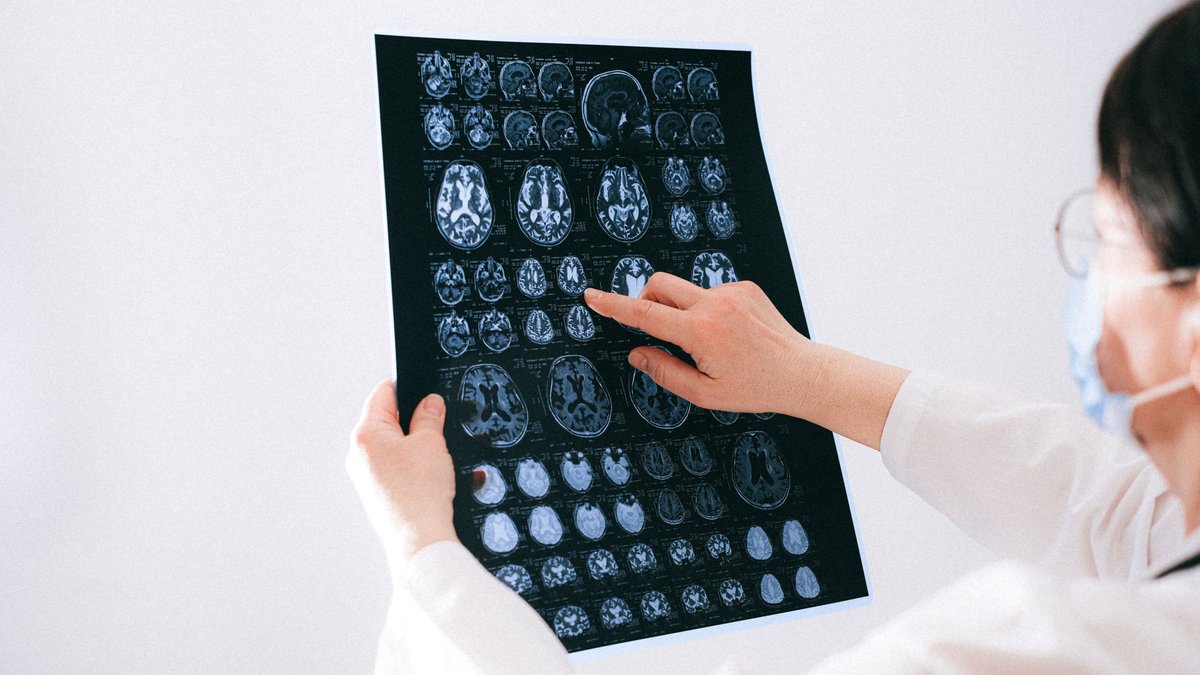 Un Gallois découvre un glioblastome après avoir consulté sur l'insistance de sa femme