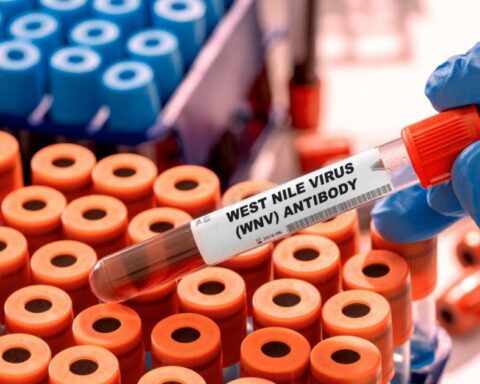 Circulation exceptionnelle du virus du West Nile en France cet été : quelles conséquences sanitaires ?