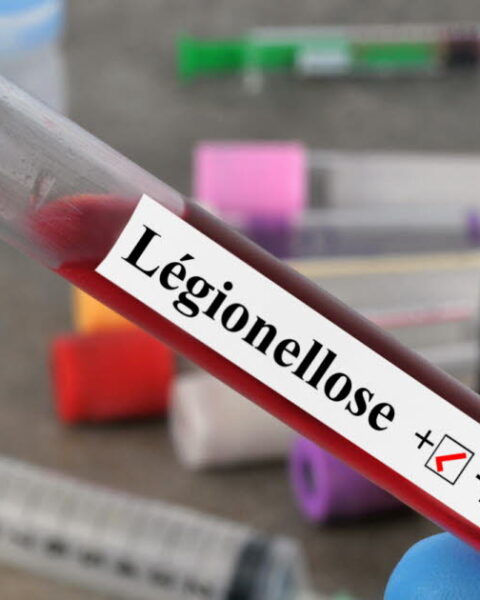 Légionellose : 48 cas en Savoie, un restaurant mal entretenu pointé du doigt