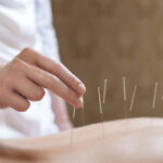 Acupuncture : quelle est la position de la science face à cette pratique de santé ?