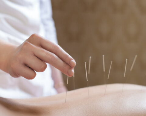 Acupuncture : quelle est la position de la science face à cette pratique de santé ?