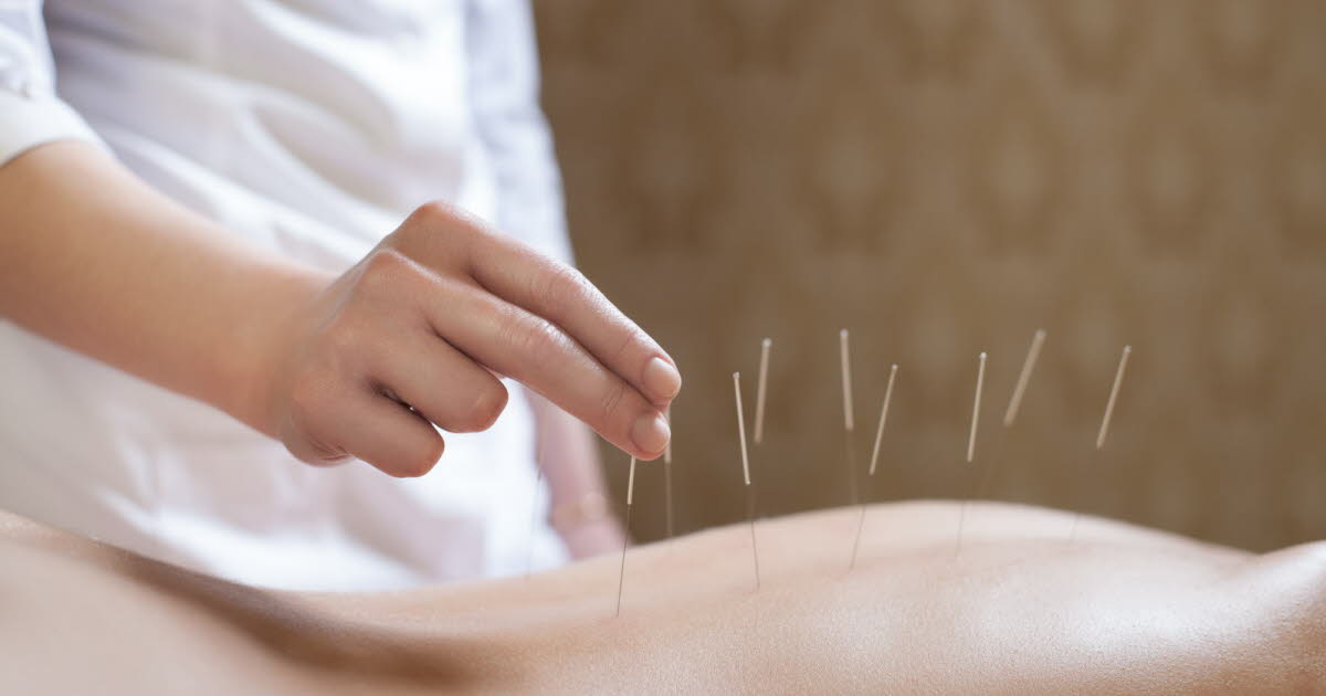 Acupuncture : quelle est la position de la science face à cette pratique de santé ?