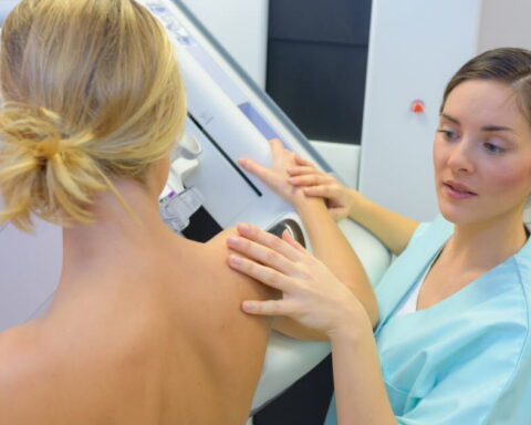 L'augmentation du cancer du sein chez les jeunes femmes en France nécessite une attention accrue